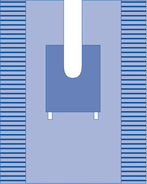 Orthopedic Split Sheet, Sterile Orthopedic Split Sheet, Sterile