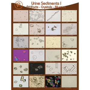 Urine Sediments, Poster I • 18"W x 24"H Urine Sediments, Poster I • 18"W x 24"H