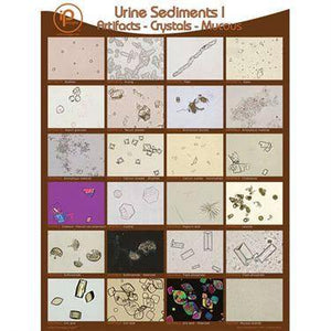 Urine Sediments, Student Binder Cards I • 8.5"W x 11"H Urine Sediments, Student Binder Cards I • 8.5"W x 11"H