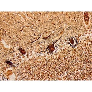 Control Slides, Bielschowsky Pos Control Slides, Bielschowsky Pos