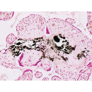 Histopathology Control Slides, Calcium Pos Histopathology Control Slides, Calcium Pos