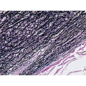 Control Slides, Elastic • Aorta Pos Control Slides, Elastic • Aorta Pos