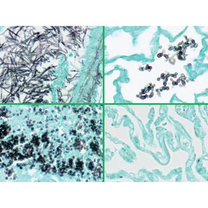 Control Slides, Fungus • GMS • Multi-Tissue • Art Pos Control Slides, Fungus • GMS • Multi-Tissue • Art Pos