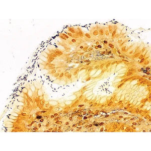 Control Slides, Histo Path Helicobacter sp. • Pos Control Slides, Histo Path Helicobacter sp. • Pos