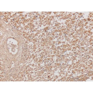 Control Slide, Alpha-Fetoprotein (AFP) Pos Control Slide, Alpha-Fetoprotein (AFP) Pos