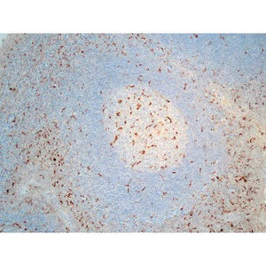 Control Slide, CD68 Pos Control Slide, CD68 Pos