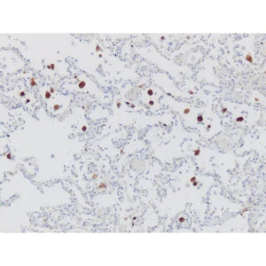 Control Slide, Cytomegalovirus (CMV) Pos Control Slide, Cytomegalovirus (CMV) Pos