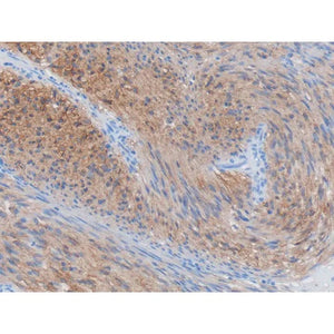 Control Slide, DOG1 Pos Control Slide, DOG1 Pos