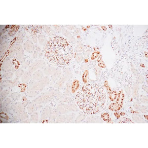 Control Slide, GATA3 Pos Control Slide, GATA3 Pos