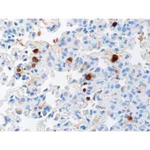 Control Slide, Toxoplasma sp. • Animal Pos Control Slide, Toxoplasma sp. • Animal Pos
