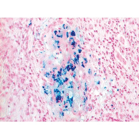 Iron Stain Set, 100mL Set