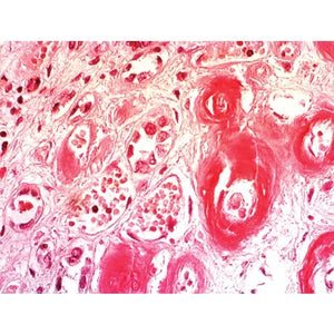 Congo Red Amyloid Stain Kit, 100mL Kit Congo Red Amyloid Stain Kit, 100mL Kit