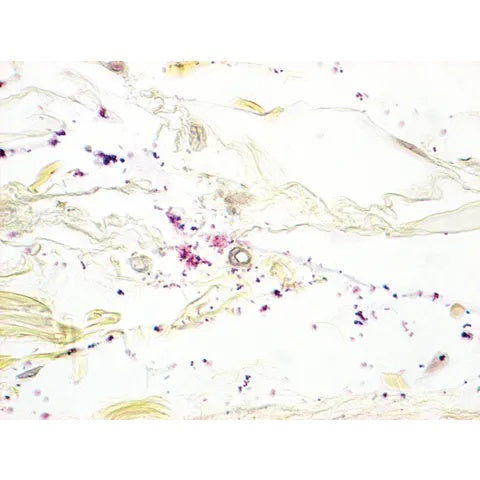 McDonald's Gram Stain Set, Gram Positive/Gram Negative Control Slides