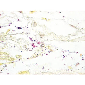 McDonald's Gram Stain Set, Gram Positive/Gram Negative Control Slides McDonald's Gram Stain Set, Gram Positive/Gram Negative Control Slides