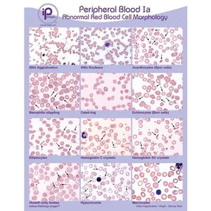 Peripheral Blood Poster • 18"W x 24"H, Abnormal Red Blood Cell Morphology Peripheral Blood Poster • 18"W x 24"H, Abnormal Red Blood Cell Morphology