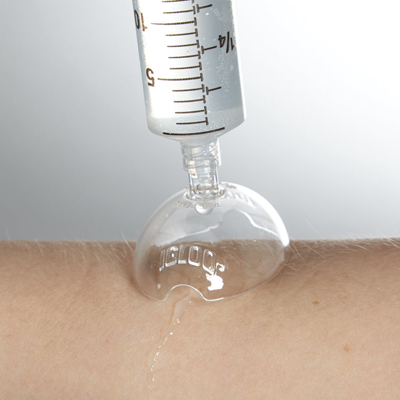 Health Care Logistics Sterile Wound Irrigation Shield