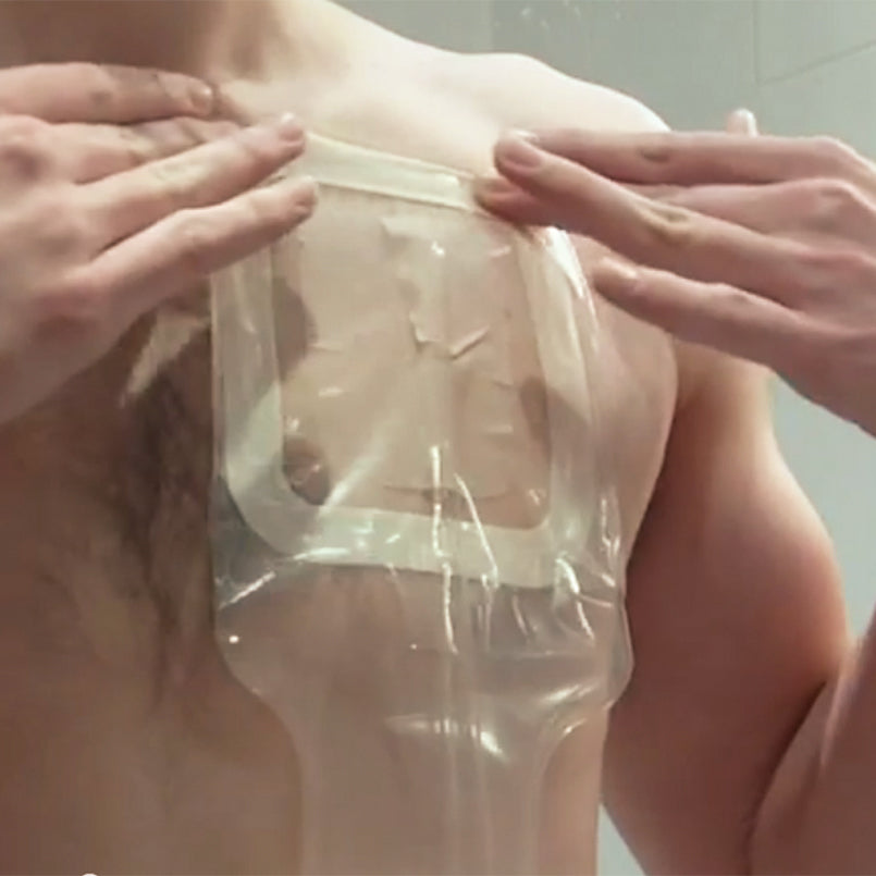 Health Care Logistics Dialtec Catheter Protectors - Large