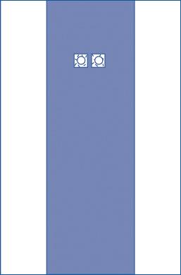 Femoral Angio Drape, 80" x 135"