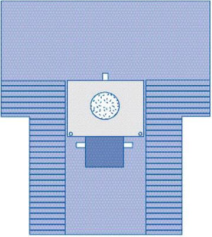 Fenestrated C-Section Drape with Pouch, Sterile