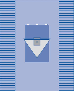 Sterile Knee Arthroscopy Drape with Fluid Control Pouch, 90" x 121"