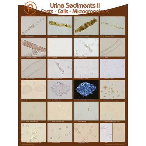 Urine Sediments, Poster II • 18"W x 24"H