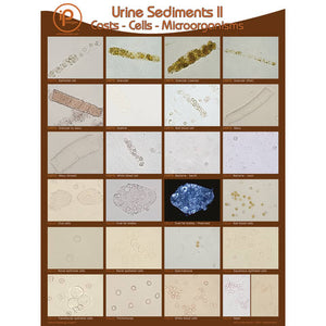 Urine Sediments, Poster II • 18"W x 24"H
