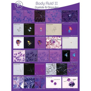 Body Fluid II: Crystals & Granules Poster