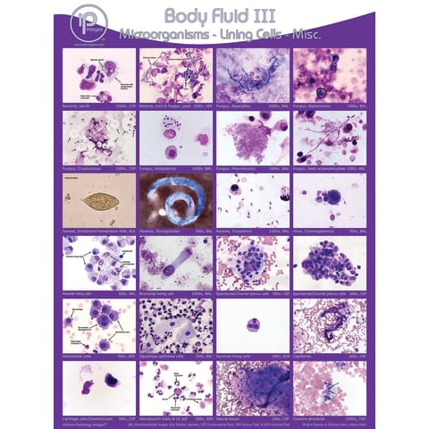 Body Fluid III: Microorganisms - Lining Cells- Misc Poster