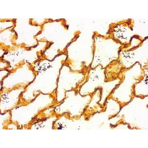 Control Slides, Cat Scratch Bartonella sp. • Art Pos