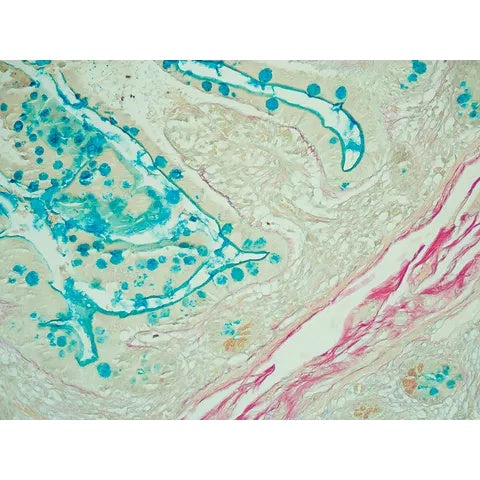 Control Slides, Colloidal Iron Pos