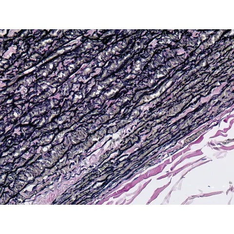 Control Slides, Elastic • Aorta Pos