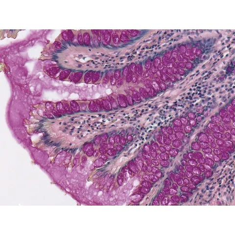 Control Slides, Mucin Mucicarmine Pos