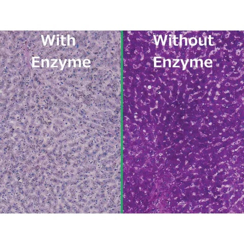 Control Slides, Periodic Acid Schiff (PAS) Glycogen Pos
