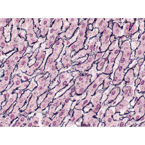 Control Slides, Reticulum Pos