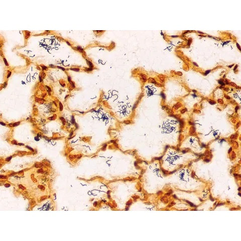 Control Slides, Spirochete • Artificial Pos