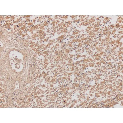 Control Slide, Alpha-Fetoprotein (AFP) Pos