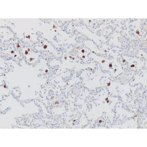 Control Slide, Cytomegalovirus (CMV) Pos