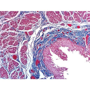 Masson Trichrome Stain Set, 100mL Set