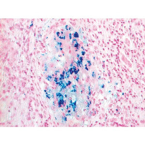 Iron Stain Set, 100mL Set