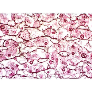 Chandler's Reticulum Stain Kit, 100mL Kit