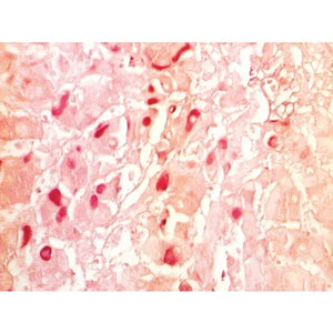 Hepatitis B Stain Kit, 100mL Kit